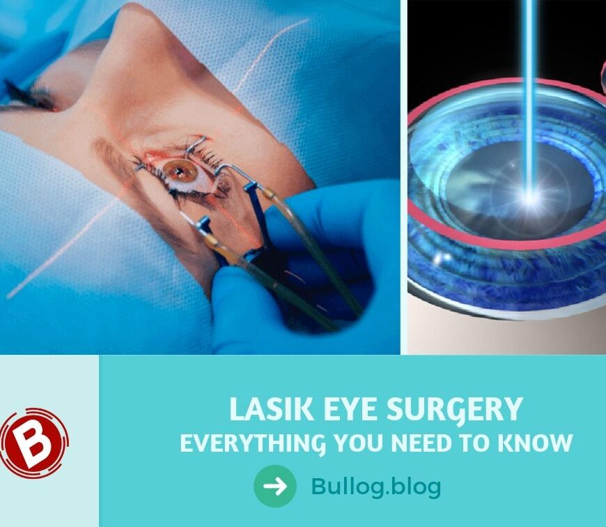 LASIK Eye Surgery