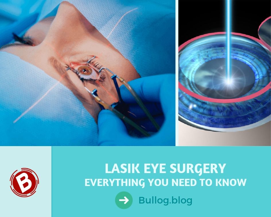 LASIK Eye Surgery